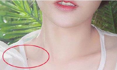 面部痣相不好怎么办 如何化解?