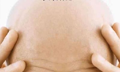 谨慎!身上九处不宜点的吉痣