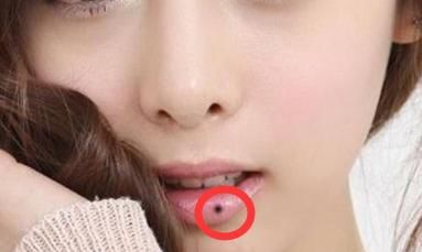 女性下嘴唇长痣代表什么命运