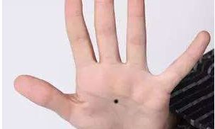 男人手掌有痣的代表什么