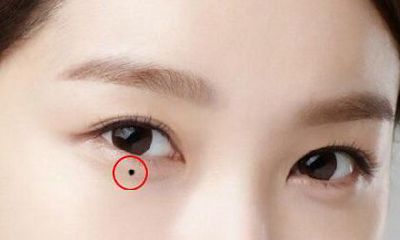 老人说的:这种痣长得越多越命苦