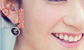 女人右耳垂有痣好不好