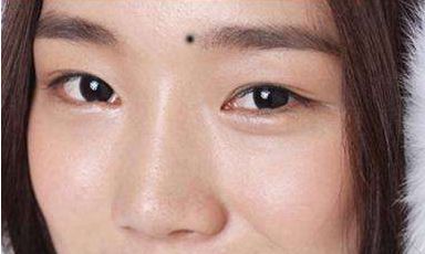 眉毛里有痣好不好 眉毛有痣图解大全