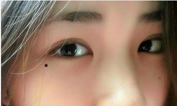眼角下长痣代表什么