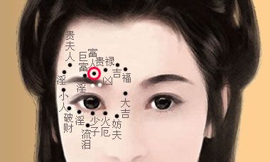 眼睛周围有痣好不好