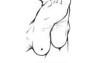 脚趾长痣代表什么