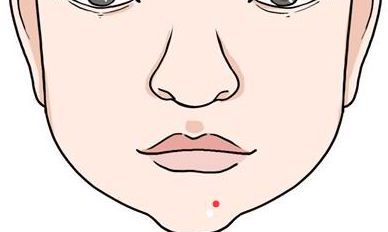 这5处吉痣做高官,赚大钱,你脸上一定会有