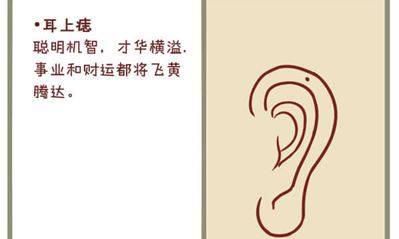 富贵痣在哪里 身体这6处有痣是吉痣,福旺财多,事业有所成