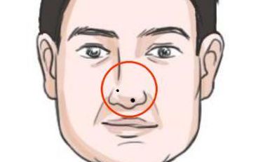 身上这几处长有痣的人为贫困痣, 一生财运差, 生活艰辛