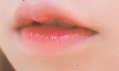 有这些痣,一生不用愁,衣食无忧,富贵到老