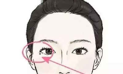 老人口中的福气痣,男女身上4大福痣解析