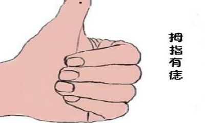 手指长痣的寓意,哪根手指长痣桃花多
