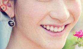 女人耳朵长痣命运好不好