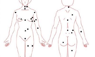 女子身上痣相的位置与命运运势