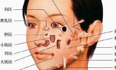 鼻子有痣好不好