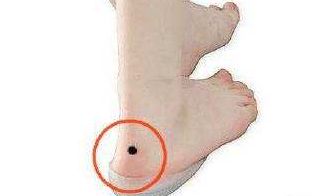 这些部位长痣的女人命运坎坷