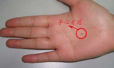 手掌心有痣的人生活富贵