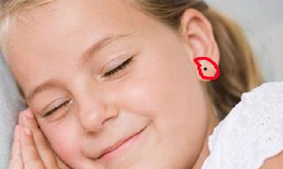 身体上这九处长痣的人容易受好运眷顾