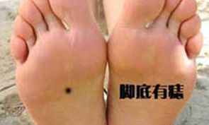 男人右脚底有痣代表什么
