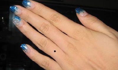 无名指长痣的人容易找一个旺自己的配偶