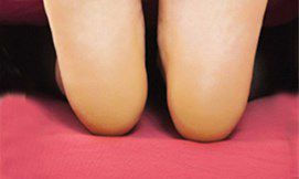 脚底长痣主富贵,如果有的话可千万别点掉!