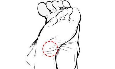 这三个地方有痣,无论男女事业皆易成功