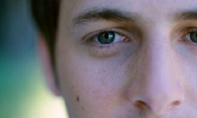 关于痣的形成,痣是怎么形成的?