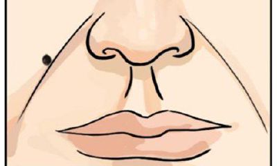 身体这几个部位长痣,要小心健康