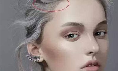 头顶长痣的人一生富贵,贵人运旺