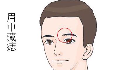 横财运旺:身上这些部位长痣的人最容易发意外之财!