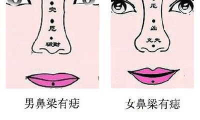 山根鼻梁上有痣的面相真的会影响婚姻吗?