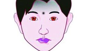 男人身上长这五种痣最容易出轨