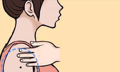 长在肩膀和手臂上的旺财吉痣,让你吃穿不愁!