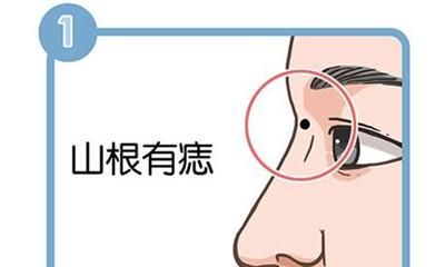 这四种鼻子上的痣,各自代表什么意义?是好还是坏?