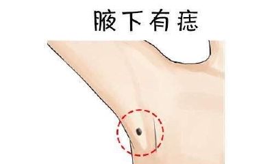 痣相看运势:腋下有痣桃花旺,头顶有痣人缘广