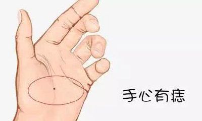 手背痣主才巧,掌中痣主富贵,你有好痣相吗?