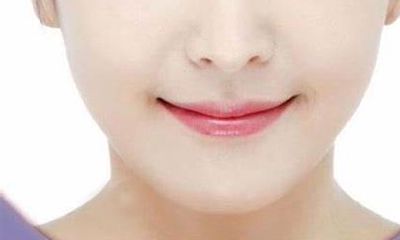 三痣相连(三颗痣)好不好