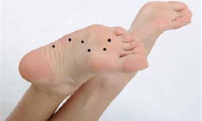 脚上长痦子好不好