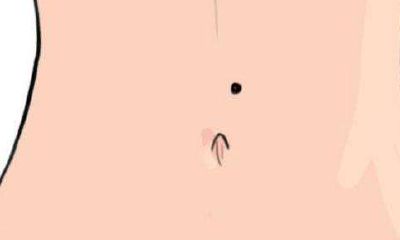 肚脐正中有痣代表什么