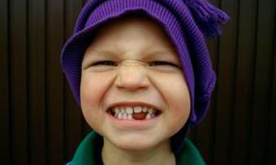 女性经常梦到掉牙(女人梦见掉牙有血不疼)