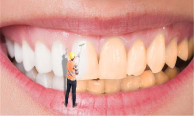 女人做梦梦到牙齿掉了半截(女人梦见补的牙齿掉了一半)