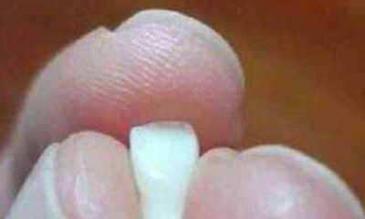 男人梦见自己的牙掉了(男人梦见下牙掉)