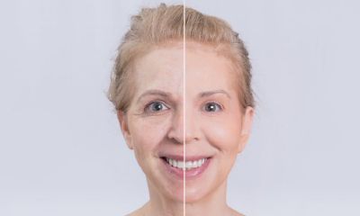 年上凸起面相(日月骨头凸起面相分析)