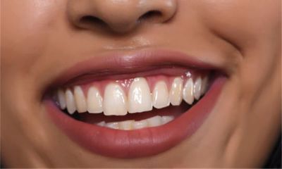 梦到掉牙齿又长牙齿是什么预兆(梦到掉牙齿后流血预兆)