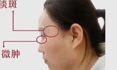 夫妻宫鼓起面相(老公非常有钱的女人面相)