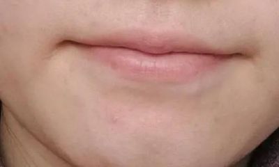 下巴有沟面相分析(下巴有沟的女人面相学)