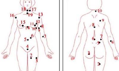 男人的眼下痣相图解大全(脸痣相图解大全男)