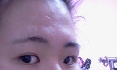 额头凹陷不平面相(脸中间凹陷的面相)