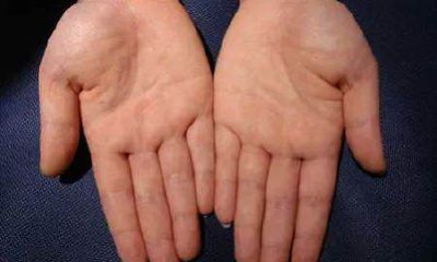 7种手相暗示大富大贵木星丘(35岁后富的手相)