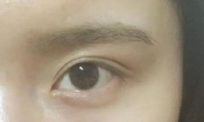 面相眼皮一单一双(眼睛一大一小面相)